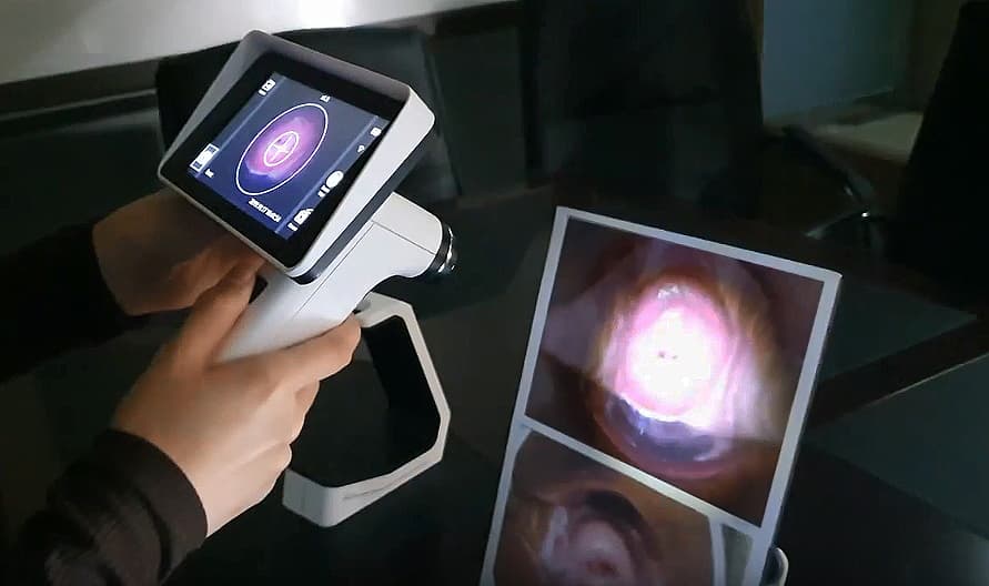 AI 자궁경부암 검사