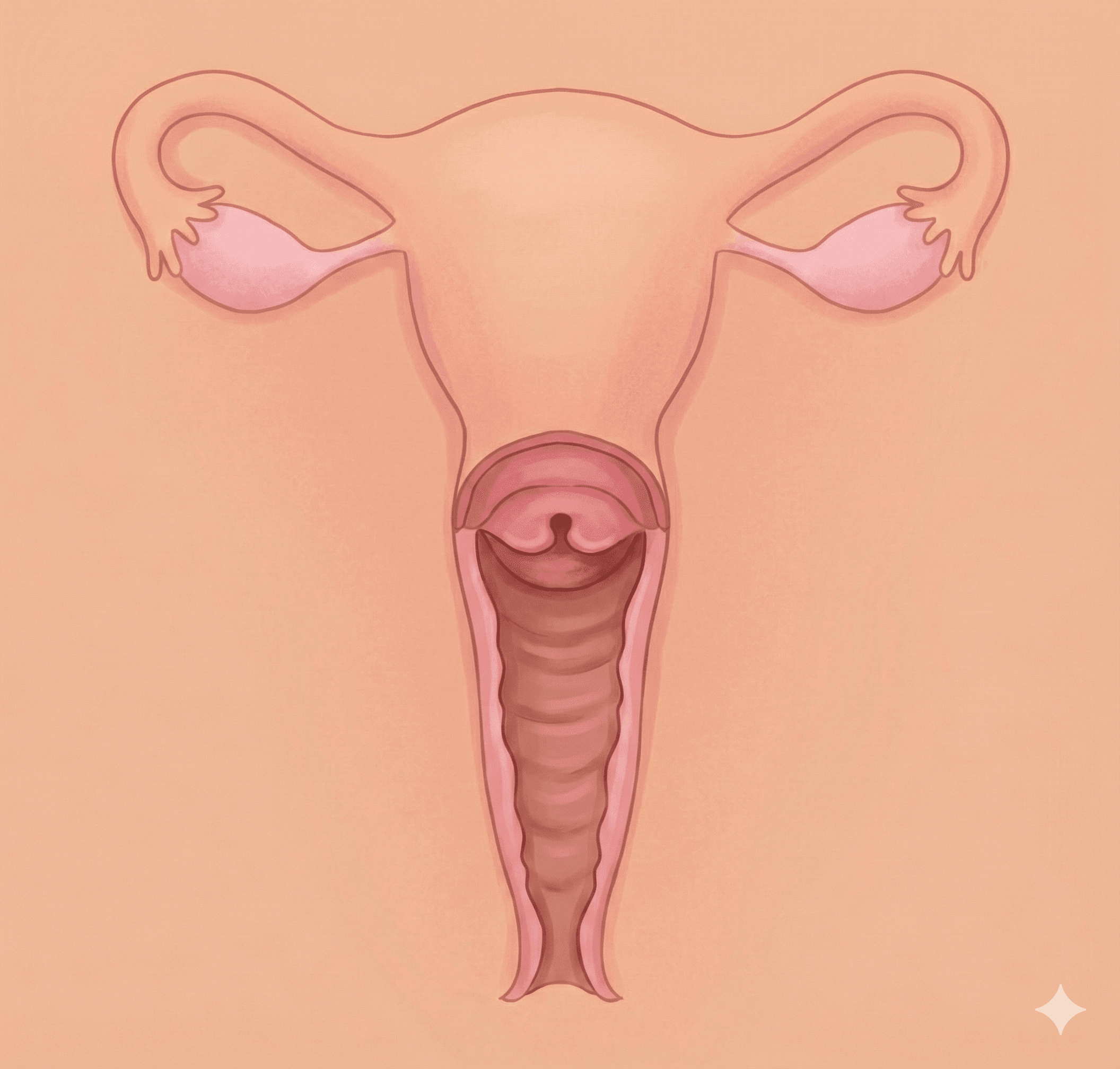 Micro-mucosal Dissection (PVD)