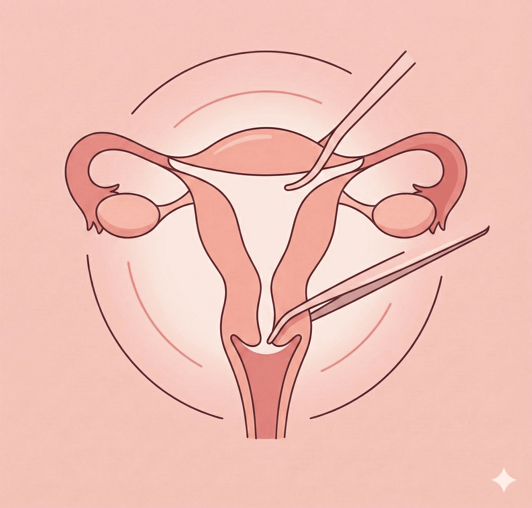 Uterine Suspension / Fixation